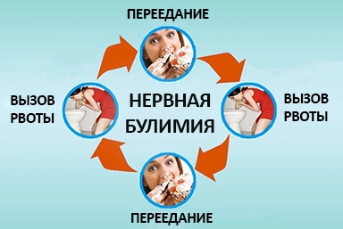 Лечение булимии в Сорске